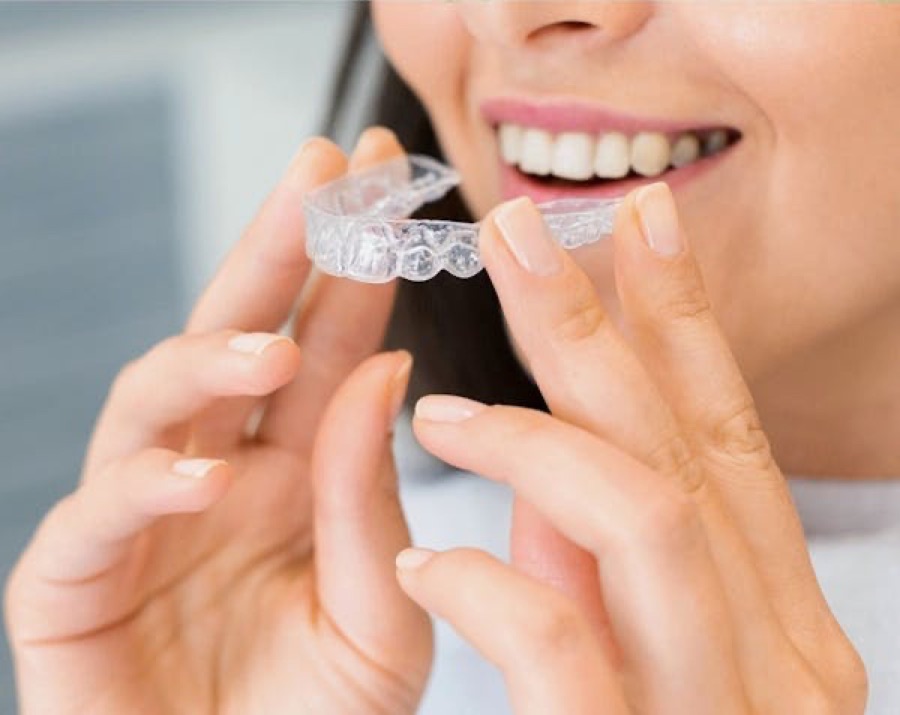 Foto: Invisalign aligners